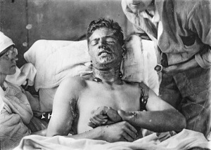 MUSTARD GAS EXPERIMENTS 2