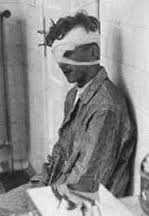 head injury experiment